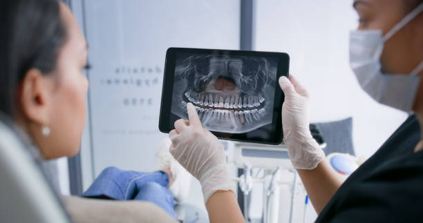Licensed Tooth Extraction service in Scotts Valley, CA - Smile Center Dentistry